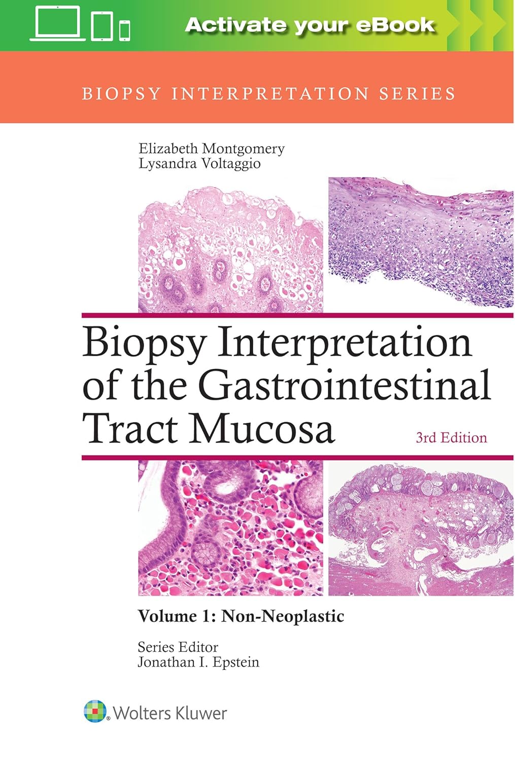 Biopsy Interpretation of the Gastrointestinal Tract Mucosa: Volume 1: Non-Neoplastic, 3rd Edition