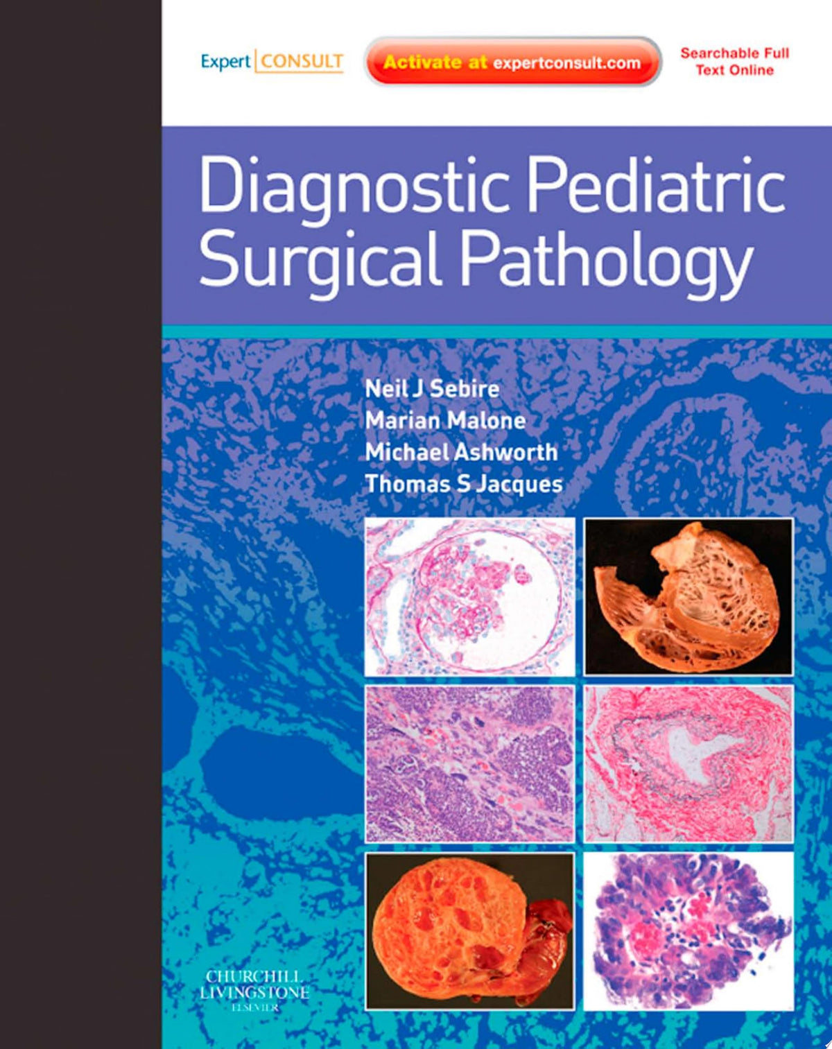 Atlas of Liver Pathology: Expert Consult – Online and Print, 3rd