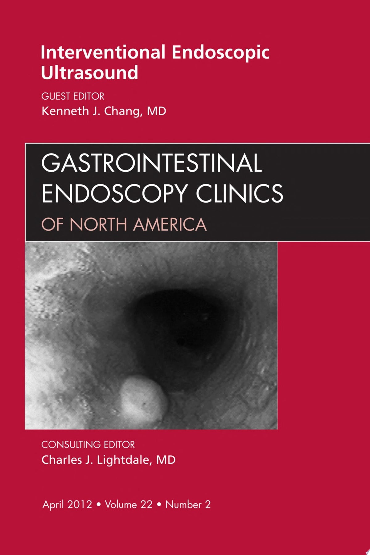 Interventional Endoscopic Ultrasound, An Issue of Gastrointestinal Endoscopy Clinics