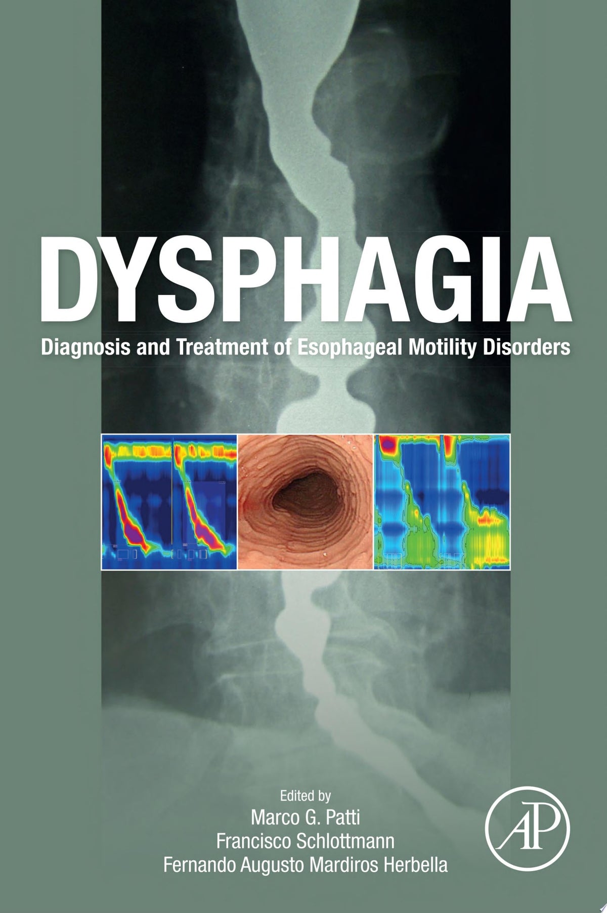 Dysphagia: Diagnosis and Treatment of Esophageal Motility Disorders
