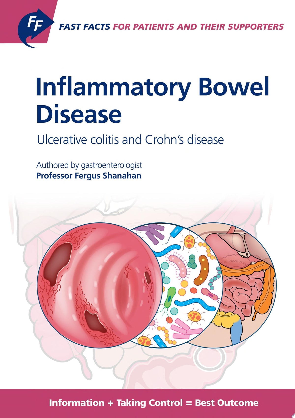 Fast Facts: Inflammatory Bowel Disease for Patients and their Supporters: Ulcerative colitis and Crohn’s disease Information + Taking Control = Best Outcome