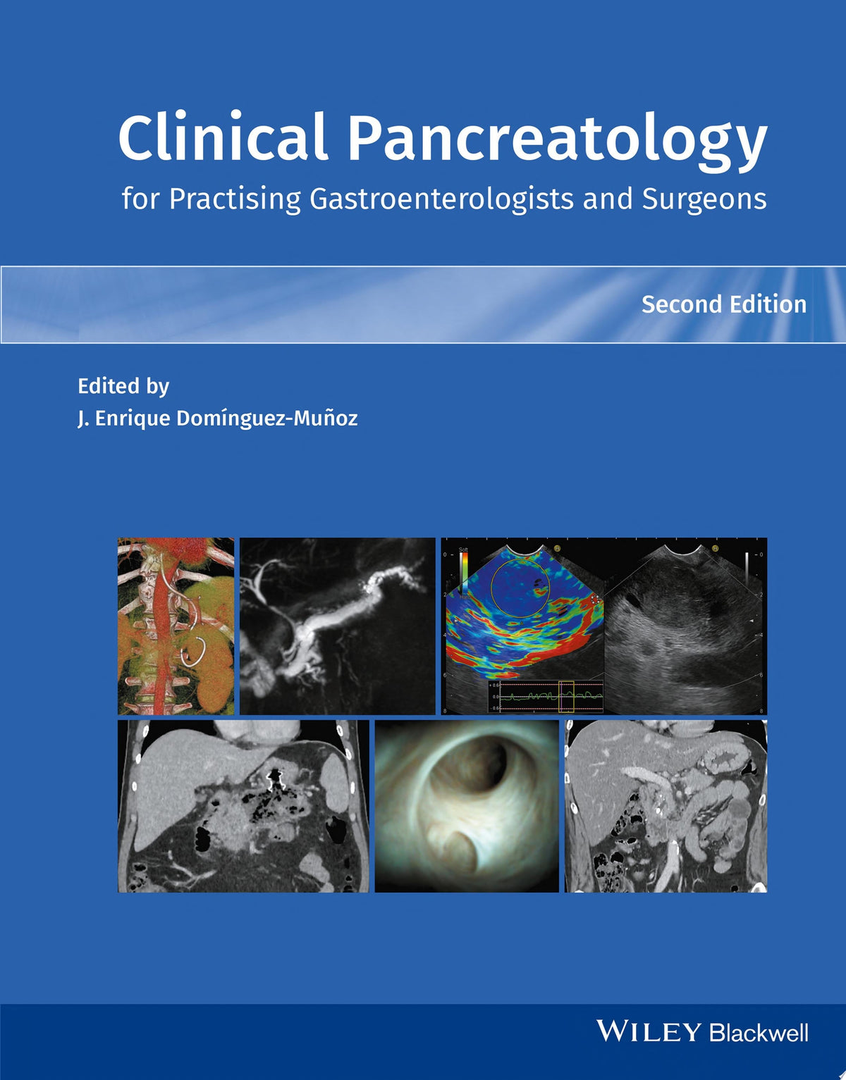 Clinical Pancreatology for Practising Gastroenterologists and Surgeons, 2nd Edition