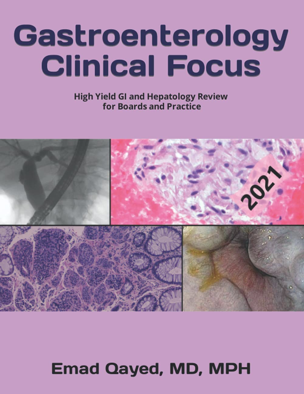 Gastroenterology Clinical Focus: High yield GI and hepatology review for Boards and Practice, 2nd edition ver 2.07