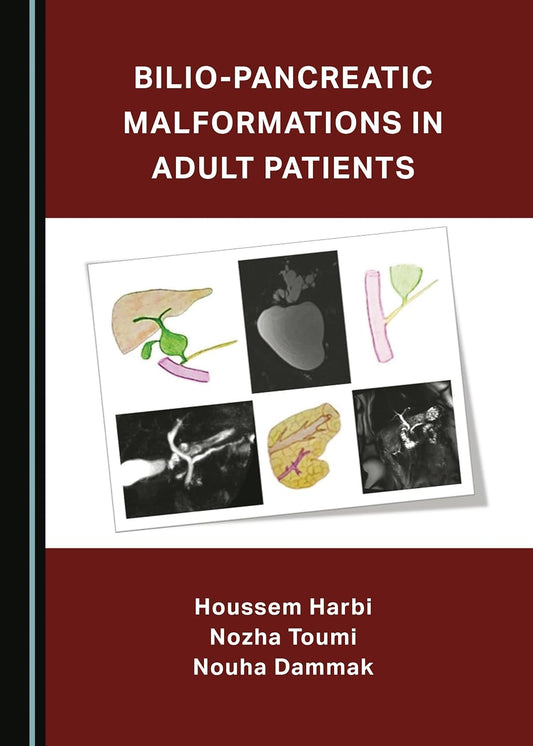 Bilio-Pancreatic Malformations in Adult Patients