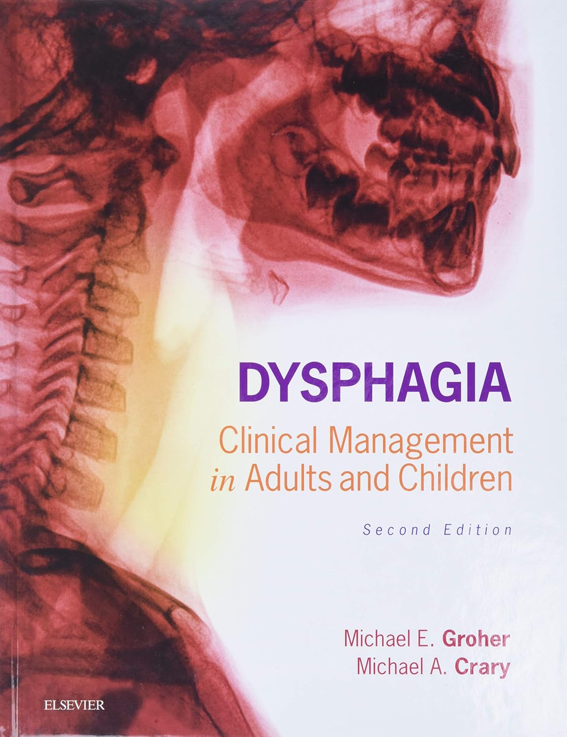 Dysphagia: Clinical Management in Adults and Children, 2nd Edition