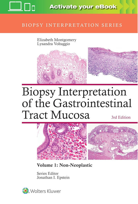 Biopsy Interpretation of the Gastrointestinal Tract Mucosa: Volume 1: Non-Neoplastic, 3rd Edition