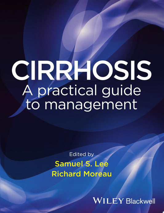 Cirrhosis: A Practical Guide to Management