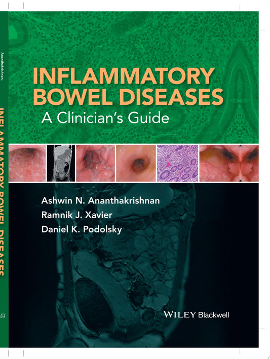 Inflammatory Bowel Diseases: A Clinician’s Guide