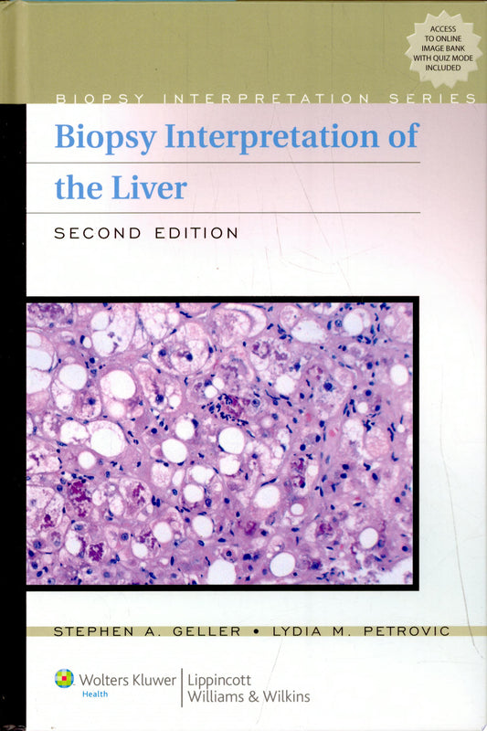 Biopsy Interpretation of the Liver