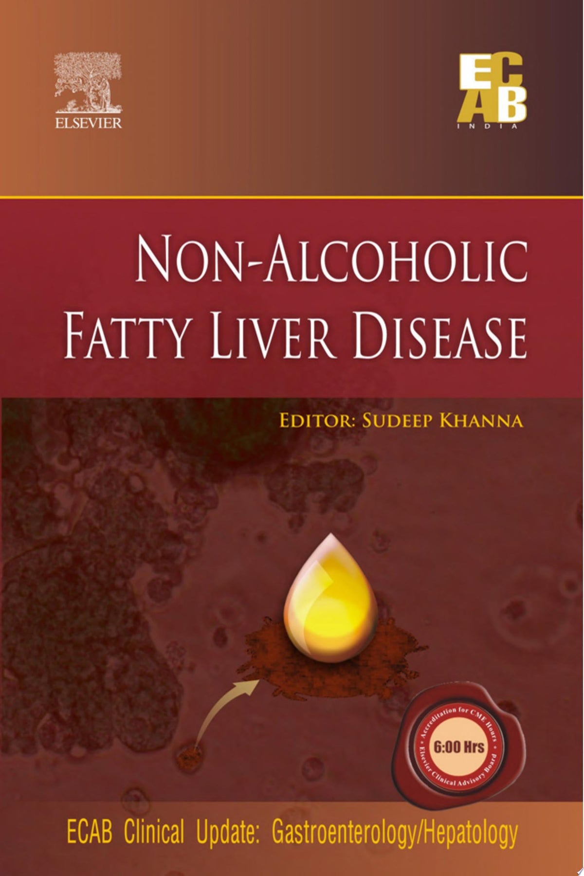 Non-Alcoholic Fatty Liver Disease – ECAB