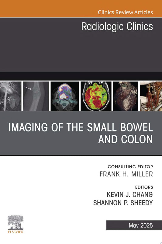 AJCC Cancer Staging System: Anus: Version 9 of the AJCC Cancer Staging System