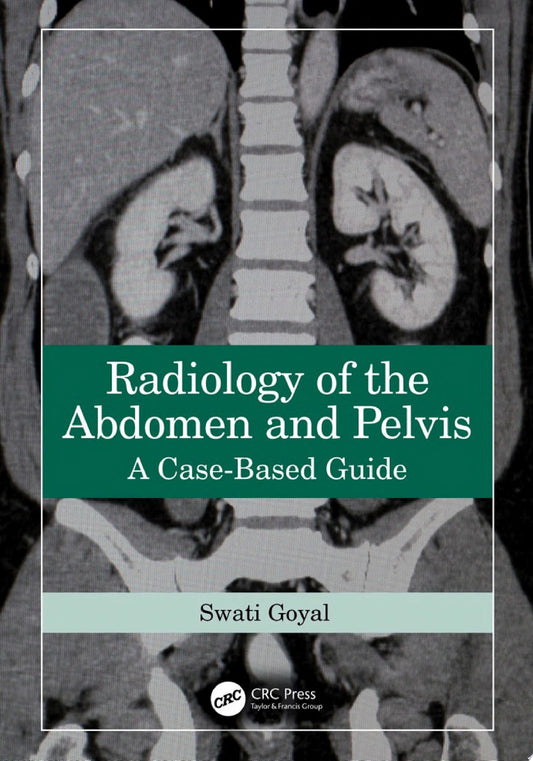 Radiology of the Abdomen and Pelvis: A Case-Based Guide, 1st Edition