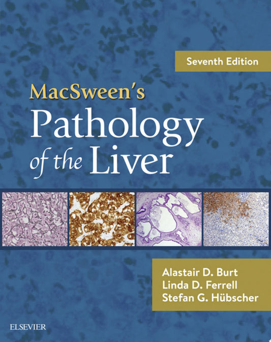 MacSween’s Pathology of the Liver, 7th Edition