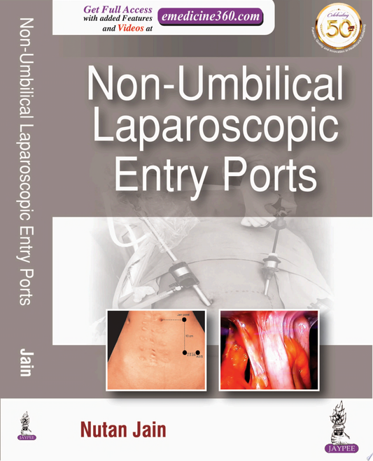Non-Umbilical Laparoscopic Entry Ports