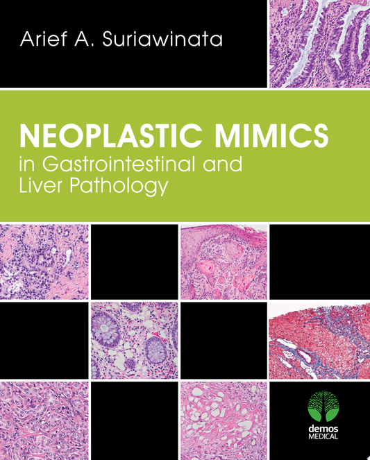 Neoplastic Mimics in Gastrointestinal and Liver Pathology