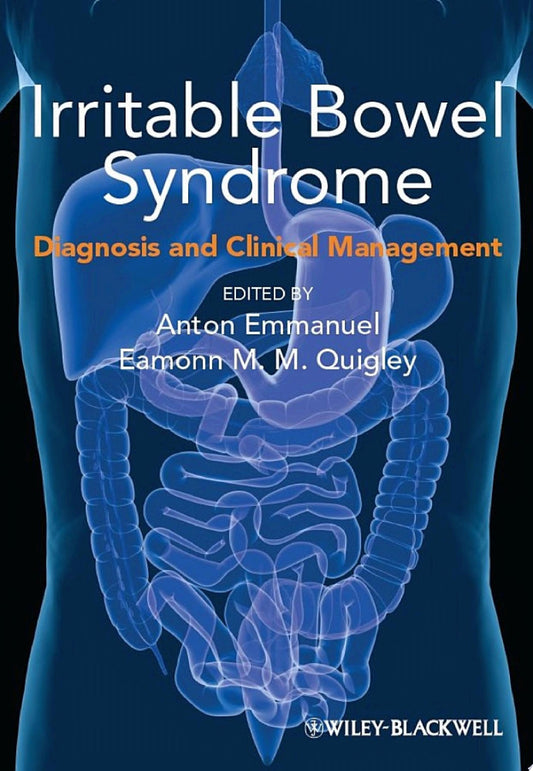 Irritable Bowel Syndrome: Diagnosis and Clinical Management