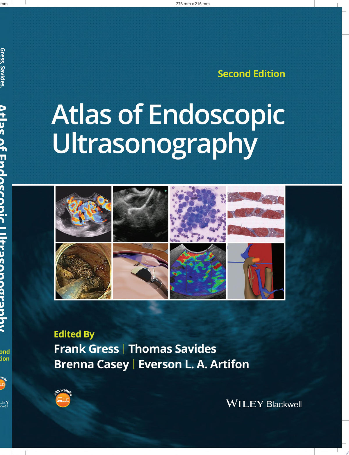 Atlas of Endoscopic Ultrasonography, 2nd Edition