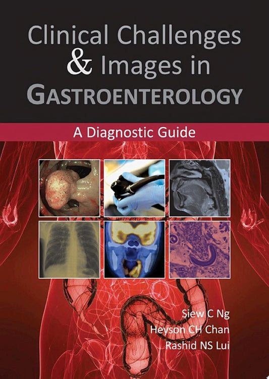 Clinical Challenges and Images in Gastroenterology: A Diagnostic Guide