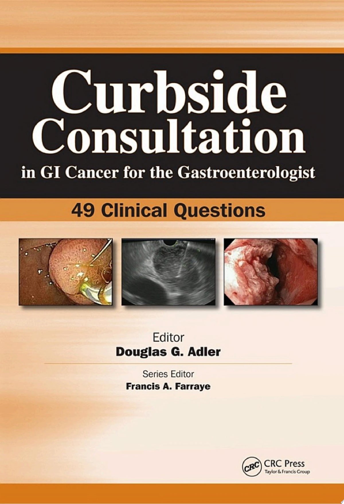 Curbside Consultation in GI Cancer for the Gastroenterologist: 49 Clinical Questions