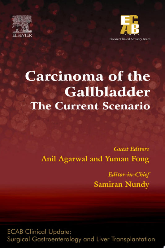 Carcinoma of the Gallbladder: The Current Scenario – ECAB
