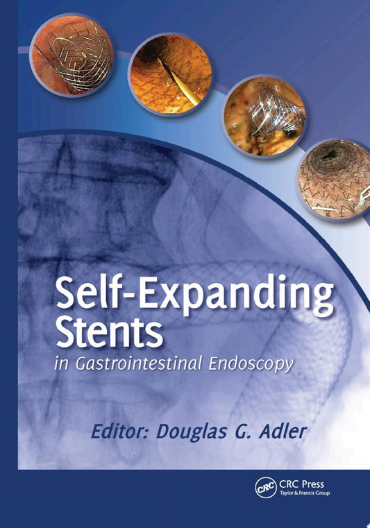 Self-Expanding Stents in Gastrointestinal Endoscopy