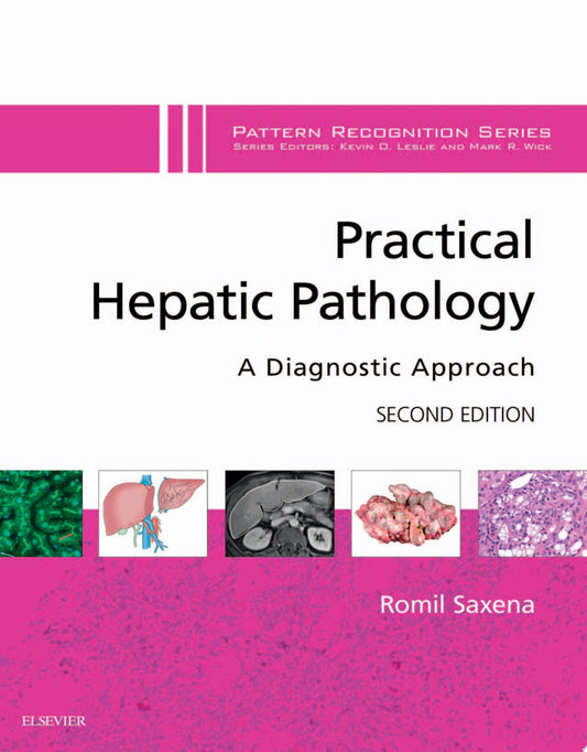 Practical Hepatic Pathology: A Diagnostic Approach: A Volume in the Pattern Recognition Series, Expert Consult: Online and Print